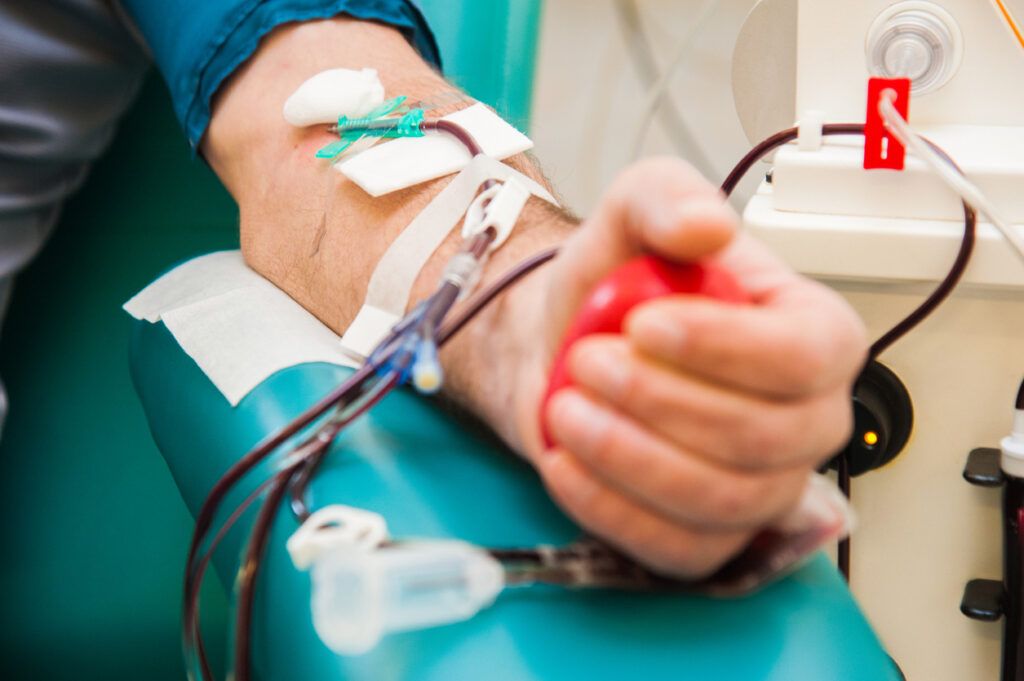 Close-up of a man donating blood or receiving dialysis while squeezing a red stress ball
