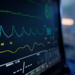 Close-up of a heart rate and vital signs monitor in a hospital setting.